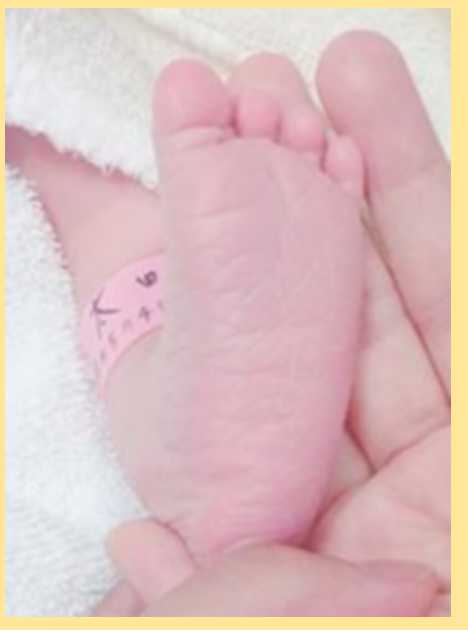 太田十愛 近藤千尋の娘 の顔画像 足の指が4本 Kerorin S Life Scoop